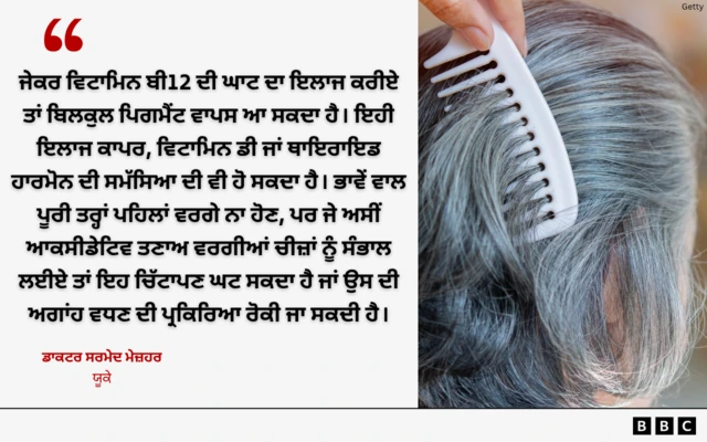 ਚਿੱਟੇ ਵਾਲ