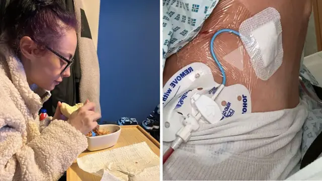 Fotos de Maisie durante a recuperação dela