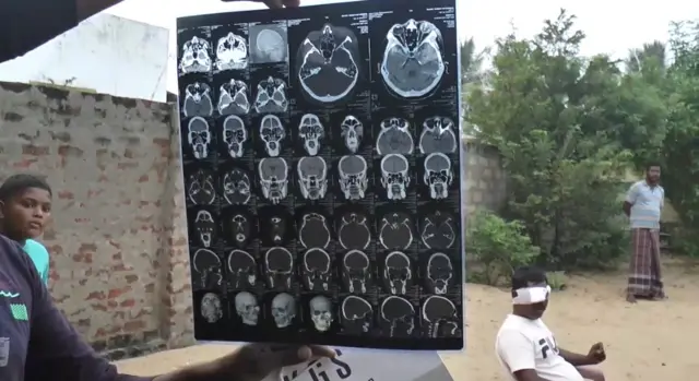 கண் பார்வையை இழந்த மீனவர்