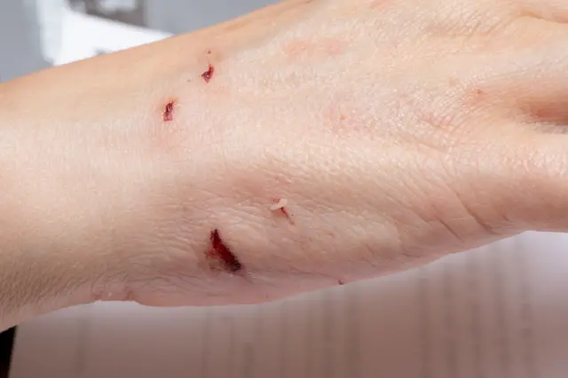 પ્રતીકાત્મક તસવીર