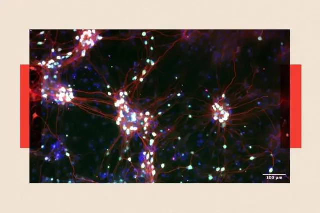 บริษัทเทคโนโลยีอย่าง Cortical Labs กำลังศึกษาเนื้อเยื่อหรือกลุ่มเซลล์ประสาทที่เพาะเลี้ยงขึ้นเอง เพื่อดูว่ามันมีสัญญาณของจิตสำนึกหรือไม่