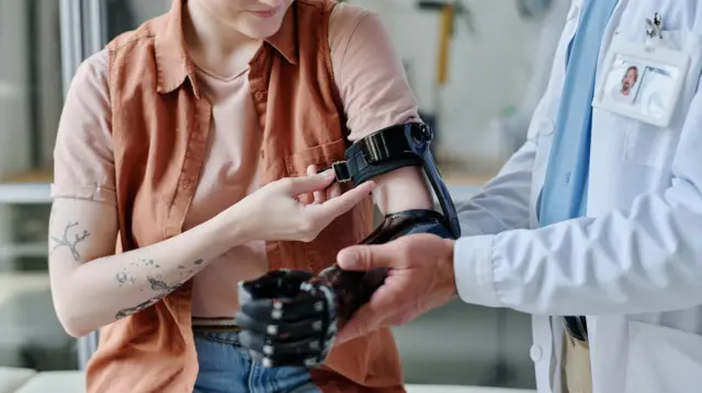un doctor le coloca una protésis a una mujer con el brazo amputado. no se ven los rostros 