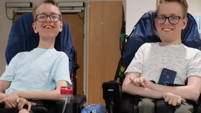 Sam (hagu) da Alex an haife su da cutar atrophy