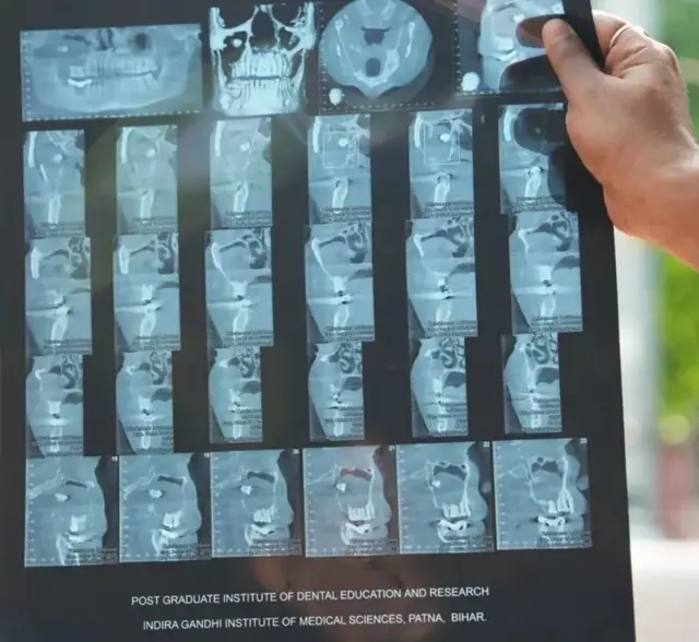 রমেশ কুমারের মুখের এক্স-রে রিপোর্টের মতো একটা রিপোর্ট হাতে ধরে আছেন এক ব্যক্তি