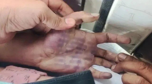 ਮਹਿਲਾ ਦੇ ਹੱਥ 'ਤੇ ਲਿਖਿਆ ਕਥਿਤ ਸੁਸਾਈਡ ਨੋਟ