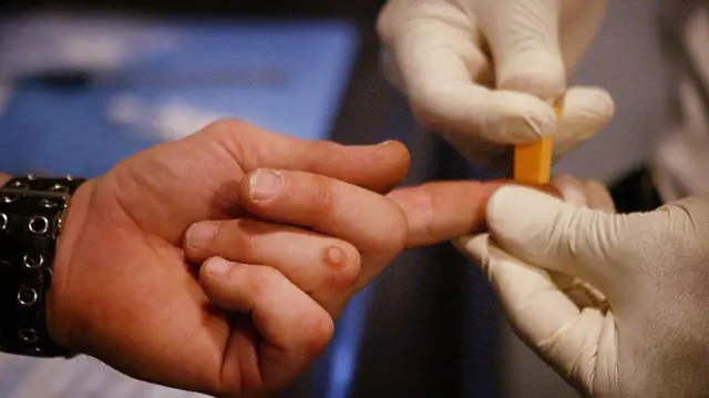 "ගොඩක් වෙලාවට HIV, හෙපටයිටිස් B වගේ ලිංගාශ්‍රිත රෝග වලට ගොදුරු වෙන්න තියෙන අවස්ථාව වැඩියි.''
