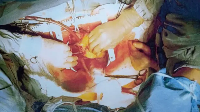 මරණයට හේතුව සොයා සටහන් කිරීමෙන් පසු මළ සිරුර යළි සැකසීමට පටන් ගනී.