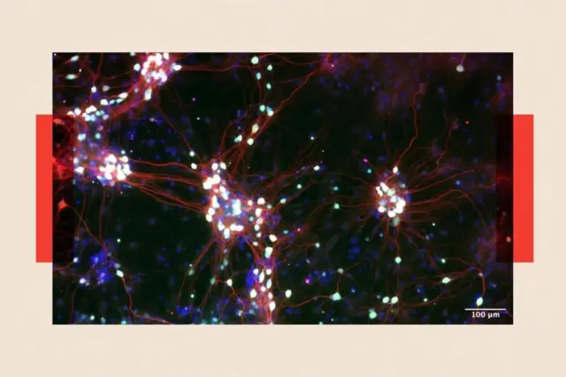 کورٹیکل جیسی کمپنیاں عصبی خلیات سے بنے 'organoids' کے ساتھ کام کر رہی ہیں۔