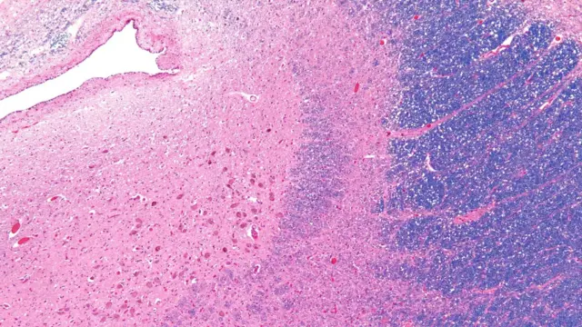 Manchas azuis e rosa