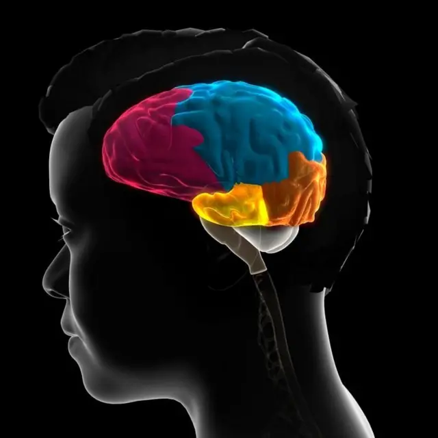 El lóbulo frontal del cerebro se puede ver en rosado, el lóbulo parietal en azul, el lóbulo occipital en naranja y el lóbulo temporal en amarillo.