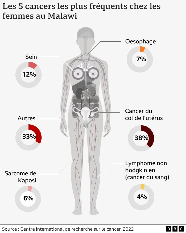 Graphique montrant le cancer du col de l'utérus en Afrique