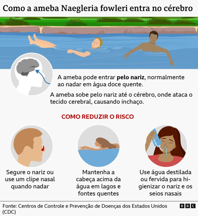 Gráfico mostrando as rotas de entrada da "ameba comedora de cérebros" e como evitar a infecção