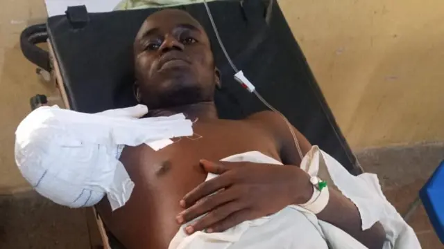 After di arm cutting