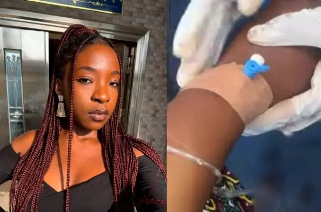 Foto Ifunanya Nwangene na foto oge e tinyere ya drip n'ụlọọgwụ