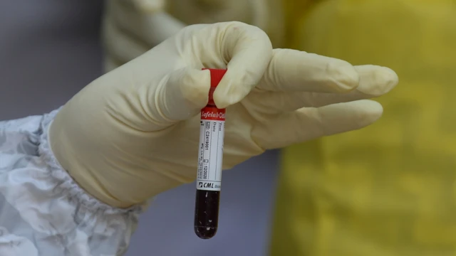 Blood test