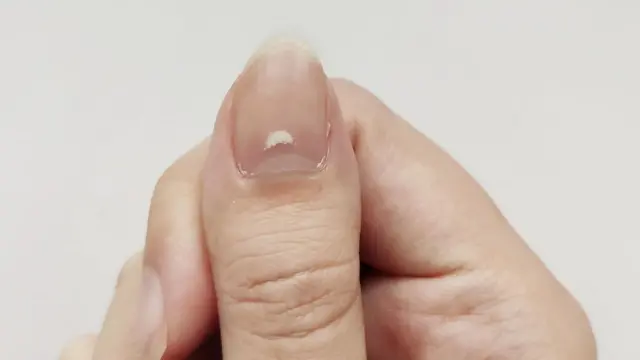 விரல் நகமும் ஆரோக்கியமும்