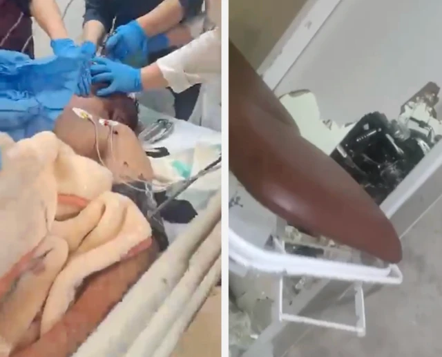 تصویر سمت راست در شکسته سردخانه در بیمارستانی در تهران را نشان میدهد. عکس دوم بیماری را نشان میدهد که پزشکان مشغول نجات او هستند.