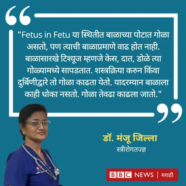 डॉ. मंजू जिल्ला यांची प्रतिक्रिया