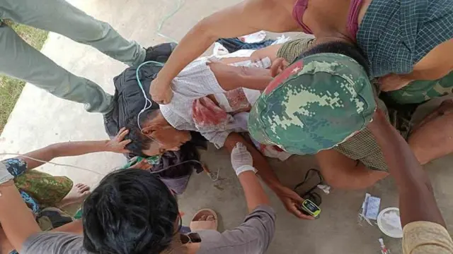 စစ်ကောင်စီတပ် ကင်းတော်ရွာကို စစ်ကြောင်းဝင်ရောက်ချိန် ထွက်ပြေးတိမ်းရှောင်ရင်း ဒဏ်ရာရသူ တစ်ဦး (ပုံဟောင်း)