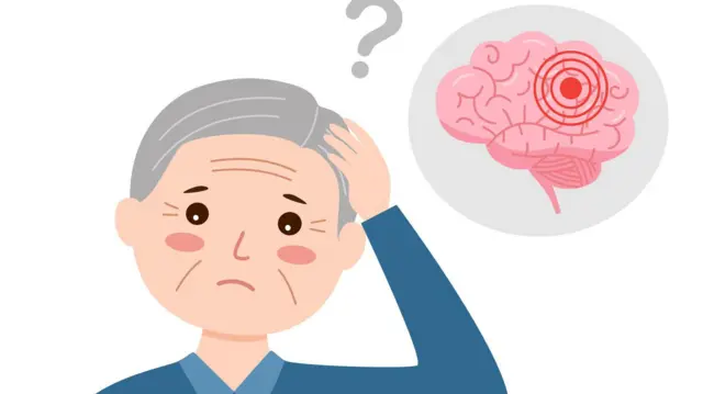 رسم يرمز إلى فقدان الذاكرة