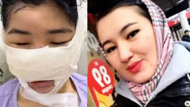 Мурдагы күйөөсү тарабынан кулак-мурду кесилген Ногойбаева жана мурдагы күйөөсү тарабынан муунтулуп өлтүрүлгөн Айкыз Калмурза кызы