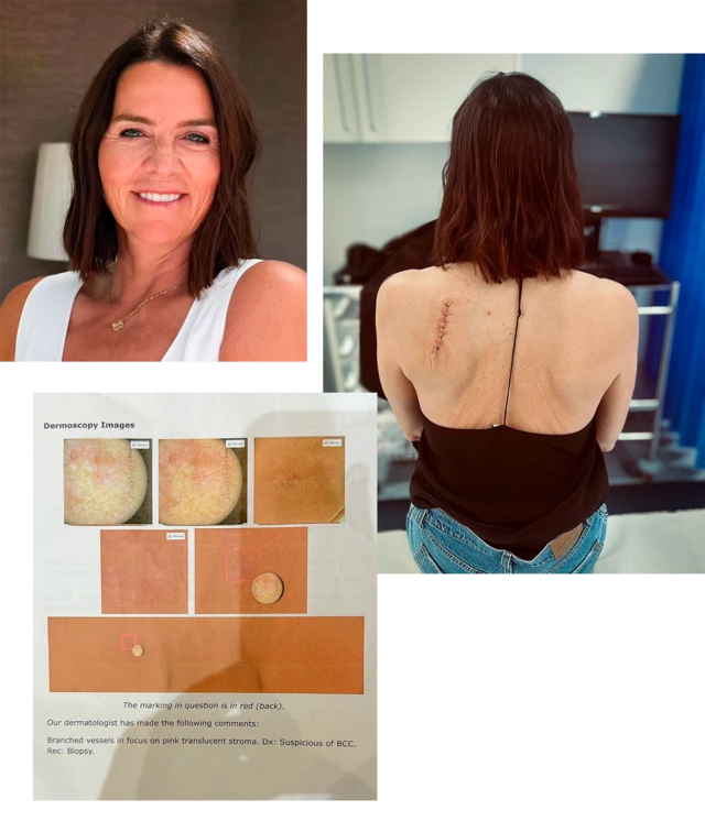 Annabel, seus exames e foto da cicatriz pós-operatória nas costas.