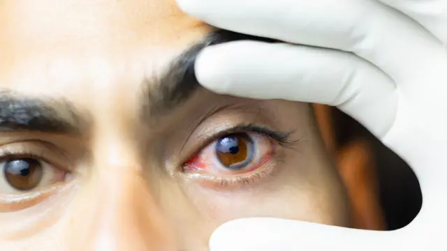 உடல்நலம்: ரத்த அழுத்தத்தைக் கண்டுகொள்ளாமல் விட்டால் என்ன பிரச்னை ஏற்படும்? 