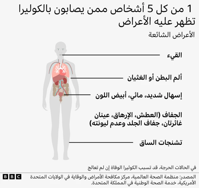 رسم توضيحي للأعراض التي تظهر على المصابين بالكوليرا.