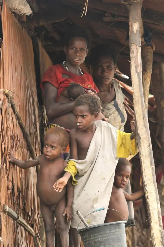 Asmat, Papua, gizi buruk, Orang Asli Papua