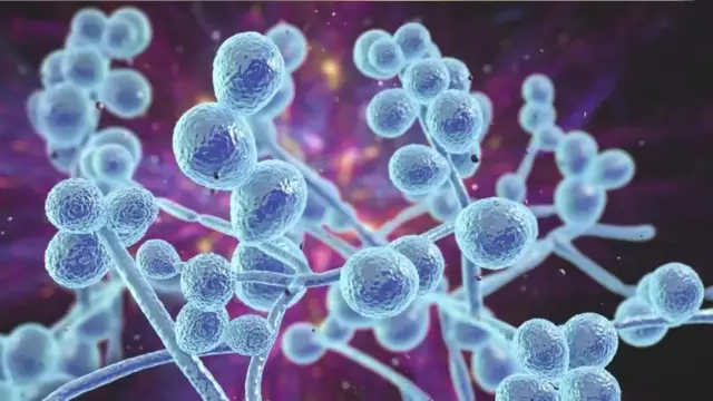 کینڈیڈا کی کمپیوٹر سے تیار کی جانے والی تصویر