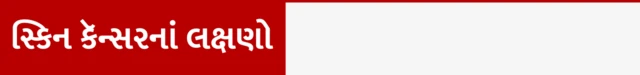 સ્કિન કૅન્સર શું છે તે કેવી રીતે થાય તથા તેના લક્ષણ, ચામડીનું કેન્સર, ગોર્ડન રામસે, ક્રિકેટર માઇકલ ક્લાર્ક, સનસ્ક્રિન લોશન ક્યારે અને કેવી રીતે વાપરવું, બીબીસી ગુજરાતી સાથે સમજો, 