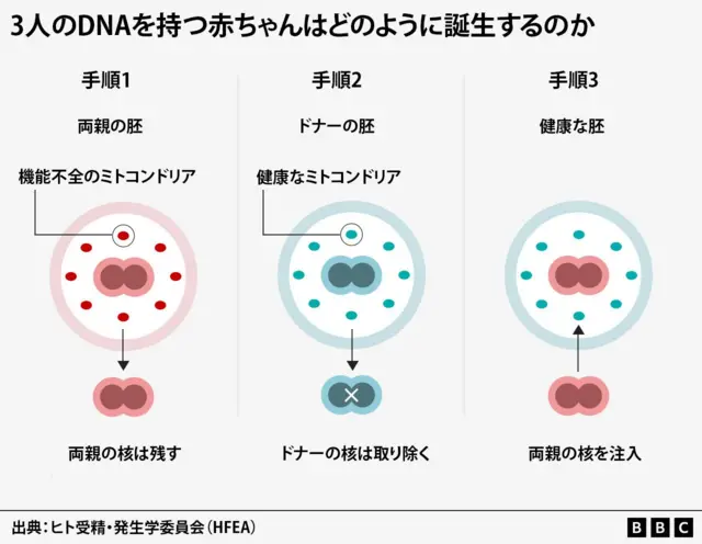 3人のDNAを持つ赤ちゃんを誕生させる手順を示す図表。手順1では機能不全のミトコンドリアがある両親の胚から核を抽出する。手順2では健康なミトコンドリアがあるドナーの胚から、ドナーの核を取り除く。手順3ではドナーの胚に両親の核を注入する