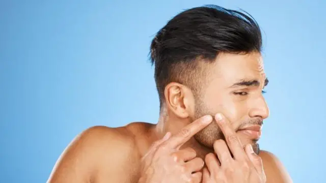 பருக்களைக் கிள்ளினால் அவை சீக்கிரம் குணமாகும் என்று சிலர் நம்புகிறார்கள். ஆனால், அவ்வாறு செய்வது வீக்கத்தை அதிகரிப்பதோடு, முகத்தில் நிரந்தரமான தழும்புகளை உண்டாக்கும்.
