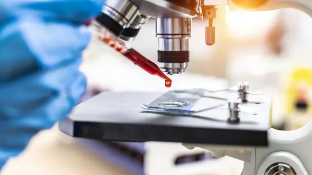 একটি অনুবীক্ষণ যন্ত্রের নিচে একটি ড্রপারের মাধ্যমে রক্তের ফোঁটা ফেলছেন নীল গ্লাভস পরা কেউ