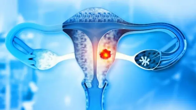 अलीकडे मोठ्या आतड्यात (कोलन) आणि मूत्रमार्गाच्या शेवटच्या भागात (मलाशय) कॅन्सरचे (रेक्टम) प्रमाण वाढत आहे.