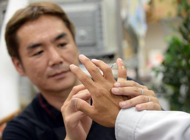 Reconstrução do dedo mínimo no Japão