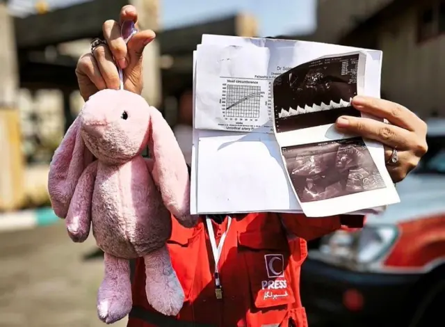 چند برگه آزمایش، سونوگرافی و یک عروسک صورتی کنار پیکر یک زن