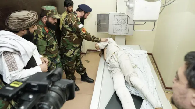 حکومت طالبان: در اثر انفجار و تیراندازی درمرز سراوان ایران ۲نفر کشته و شماری زخمی شدهاند