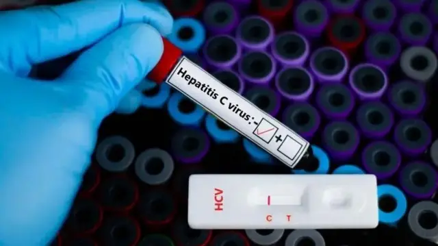 लिव्हर कॅन्सर