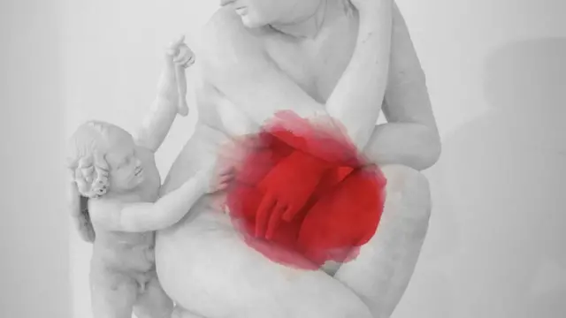 ਐਂਡੋਮੇਟ੍ਰੀਓਸਿਸ