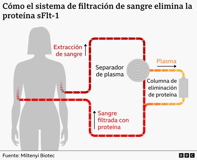 gráfico del sistema de filtración de sangre