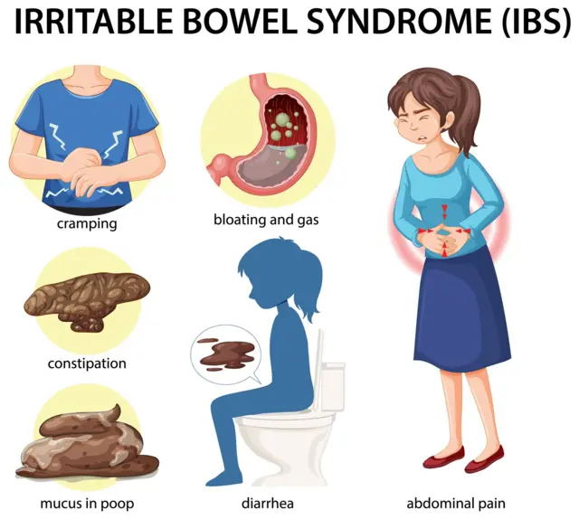 ਇਰੀਟੇਬਲ ਬੋਅਲ ਸਿੰਡਰੋਮ