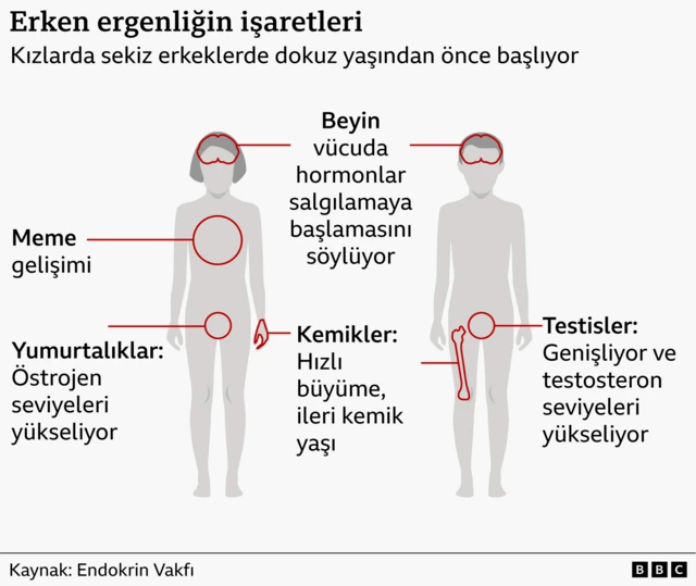 Bilgi grafiği, beynin ergenliği nasıl tetiklediğini, bunun da seks hormonlarının üretiminin artmasına ve cinsel özelliklerin gelişmesine nasıl yol açtığını göstermektedir.