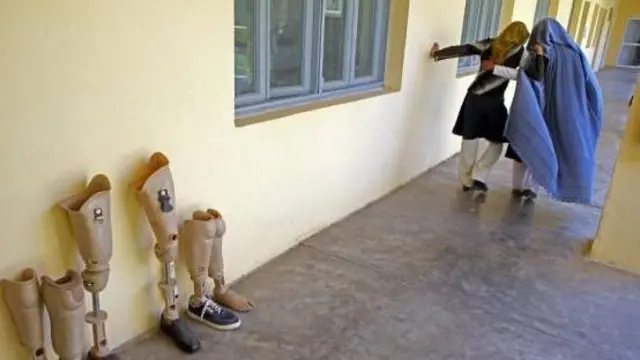 تصویر یک زن که کمک می‌کند دختر معلولش راه برود. در کنار تصویر چند پای مصنوعی نیز دیده می‌شود. این دو در یک مرکز صحی هستند. 