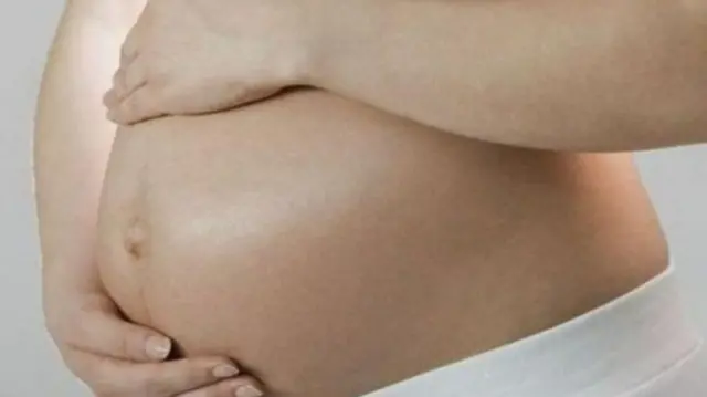 प्रातिनिधिक छायाचित्र 