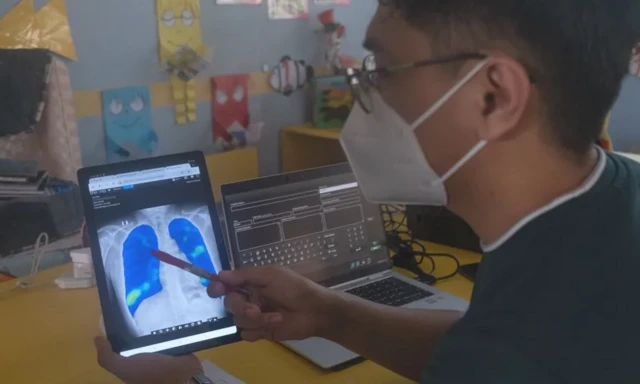 Les appareils de radiographie portables produisent désormais des images d'une qualité similaire à celle des grands appareils fixes des hôpitaux.