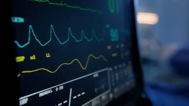 পালস মনিটর