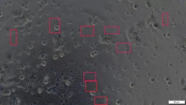 The SpermSearch system quickly identifies sperm, and draws a rectangle around them on the screen