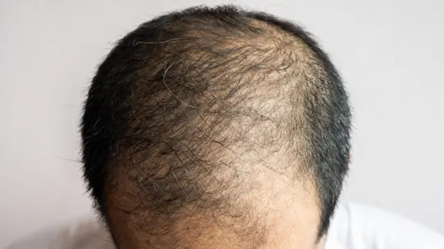 ప్రతీకాత్మక చిత్రం