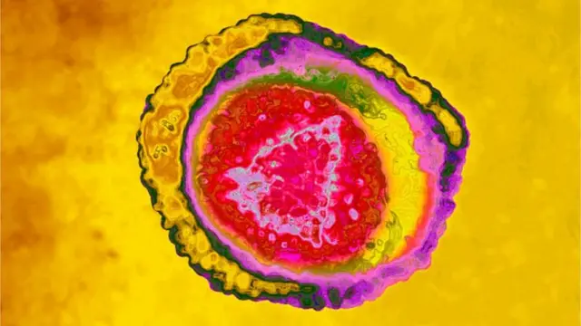 హెర్పెస్ వైరస్